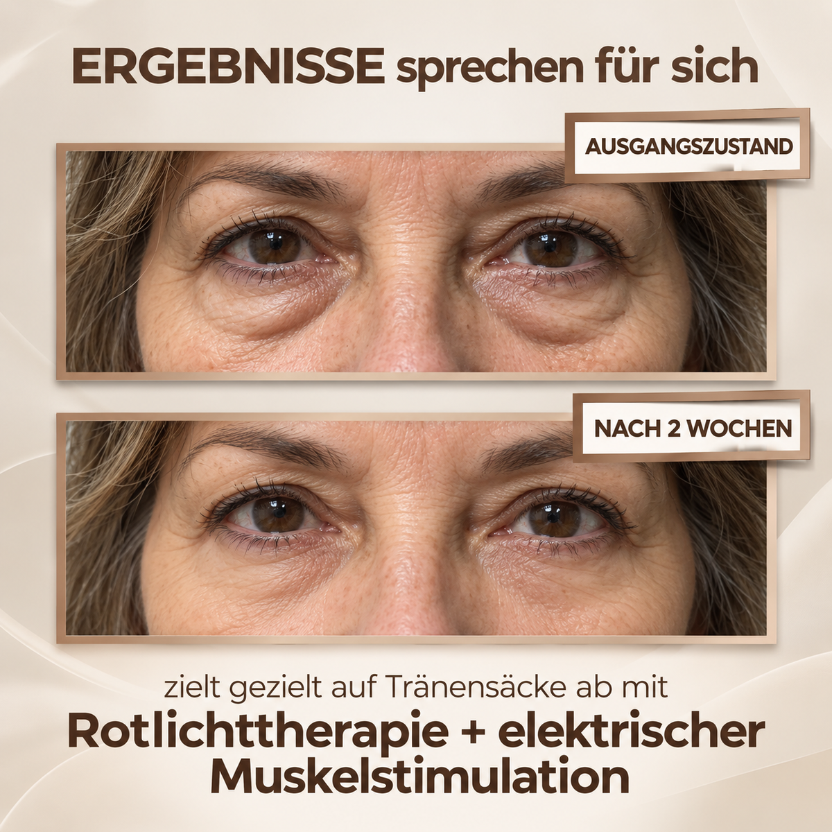 VELA EyeLift Pro | Gegen Augenringe & Tränensäcke